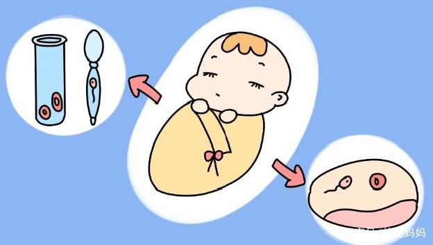 胎儿大小评估
