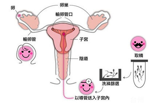 血糖高